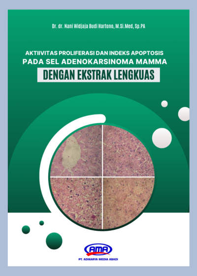 Aktivitas Proliferasi Dan Indeks Apoptosis Pada Sel  Adenokarsinoma Mamma Dengan Ekstrak Lengkuas